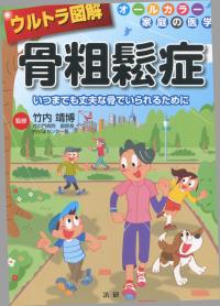 ウルトラ図解 骨粗鬆症 いつまでも丈夫な骨でいられるために