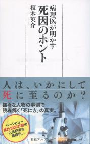 病理医が明かす 死因のホント